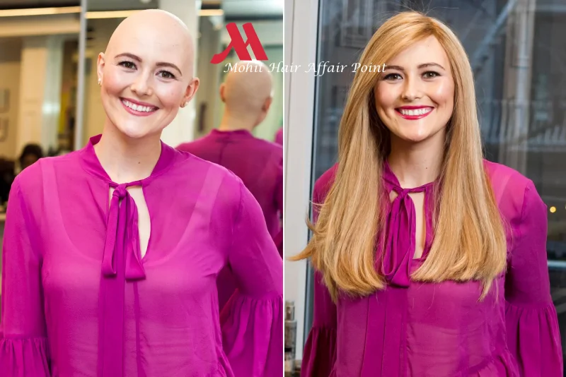About Us 6 Hair Wigs For Cancer Patients