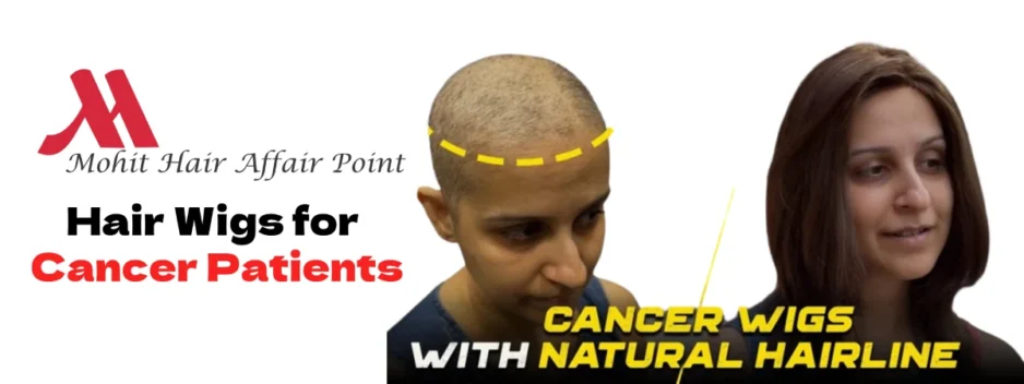 Know the 7 Reasons to Buy Hair Wigs for Cancer Patients in Lucknow!