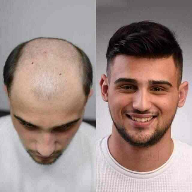 hair weaving in lucknow