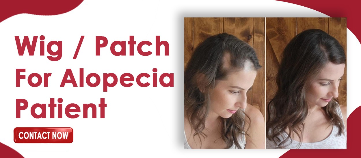 hair patch
