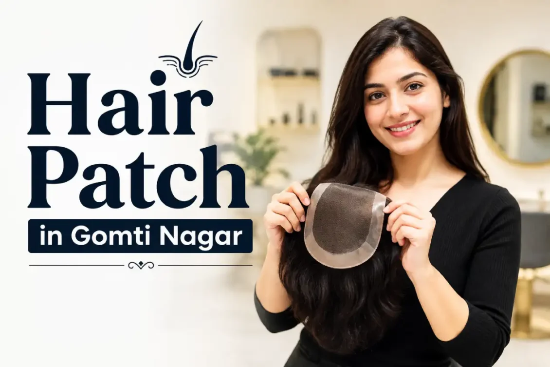 Hair Patch in Gomti Nagar: Natural-Looking Hair Replacement for Men 1 Hair Patch in Gomti Nagar